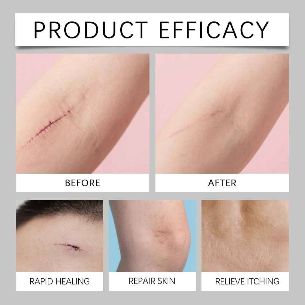 Scar Care Stick Moisturizing For Face Body Skin Smoothing Hydrating Daily Scar Repair Cream Reduce Redness Dryness Care Balm