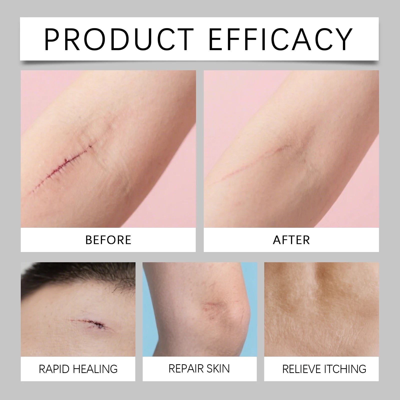 Scar Care Stick Moisturizing For Face Body Skin Smoothing Hydrating Daily Scar Repair Cream Reduce Redness Dryness Care Balm