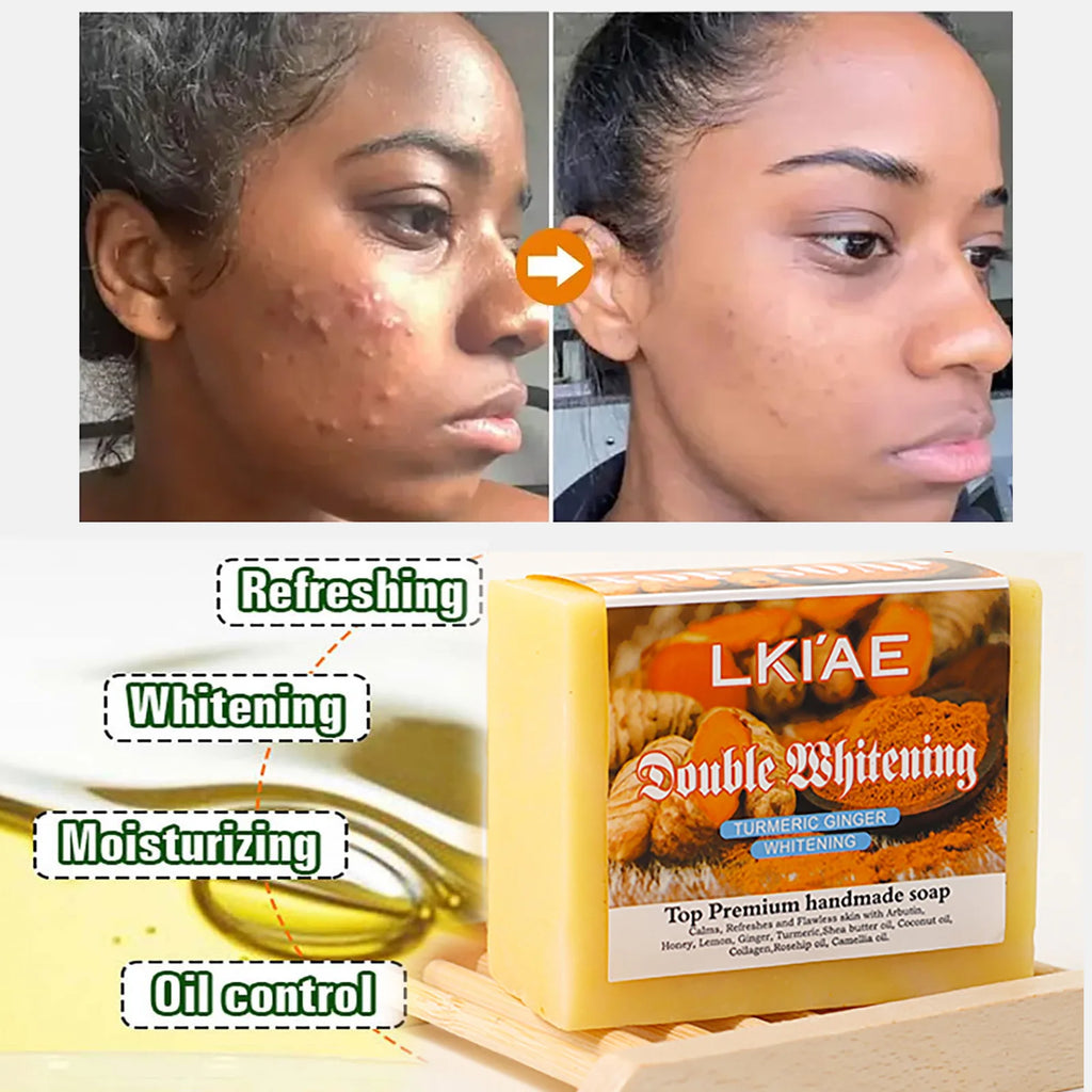 LKIAE Natural Turmeric Whitening Soap Bar, Anti Acne, Dark Spots, Moisturize and Smoothen Skin, With Honey, Glycerin, 150g