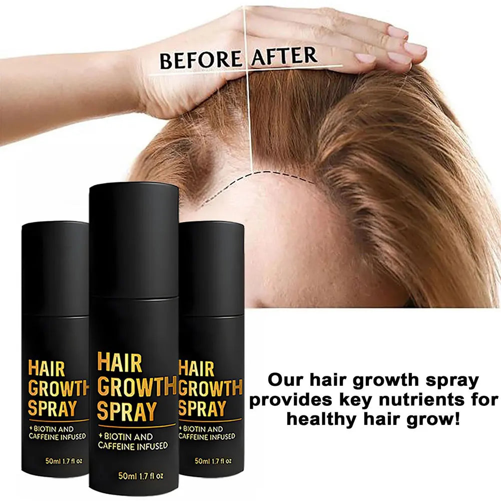 50ml Hair Growth Spray Hair Growth Promotes Thicker Fuller Hair For Women & Men All Hair Types With Natural Ingredients