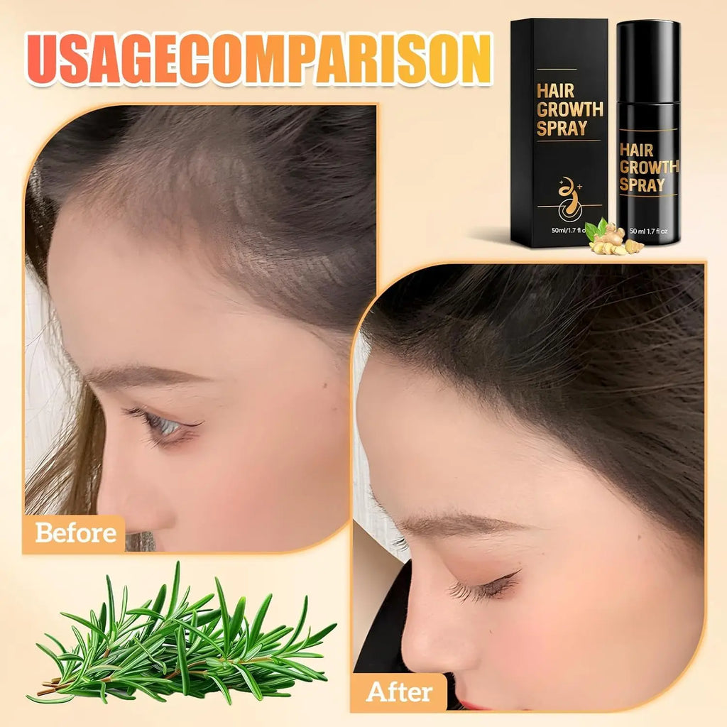 50ml Hair Growth Spray Hair Growth Promotes Thicker Fuller Hair For Women & Men All Hair Types With Natural Ingredients