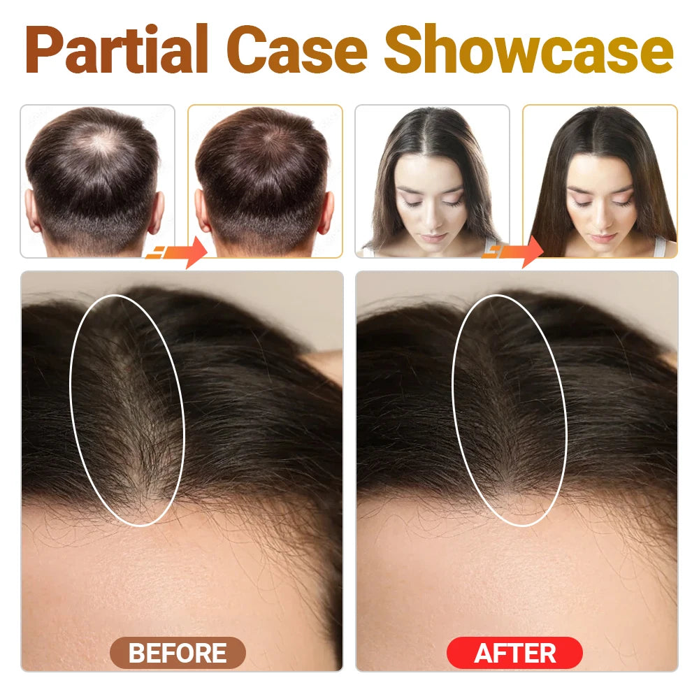 Clinical Grade LLLT Hair Regrowth Device Anti Hair Loss Machine For Scalp Health Thinning Hair Stress Anxiety Management