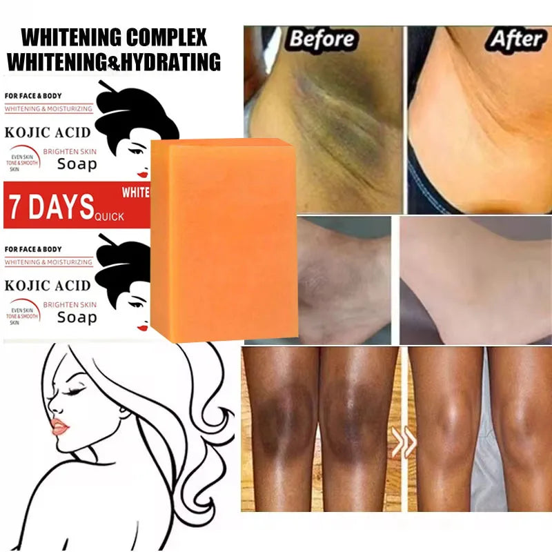 Kojic Acid Body Whitening Soap Deep Skin Bleaching Brighten Body Scrub Knees Intimate Parts Armpits White Nourishing Care Soap
