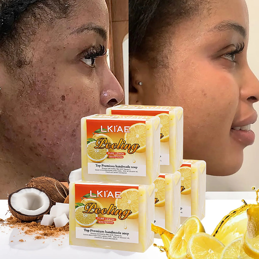 LKIAE Pure Natural Lemon Whitening Soap Bar, Face & Body Cleanser, Oil Control, Remove Acne, Dark Spots, Blackheads, 150g