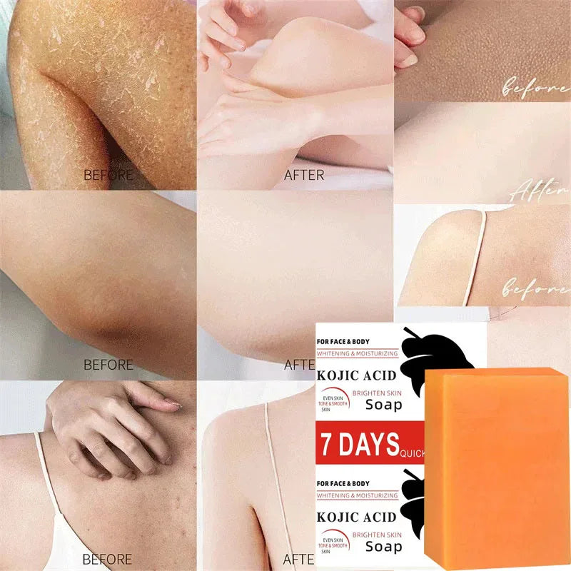 Kojic Acid Body Whitening Soap Deep Skin Bleaching Brighten Body Scrub Knees Intimate Parts Armpits White Nourishing Care Soap
