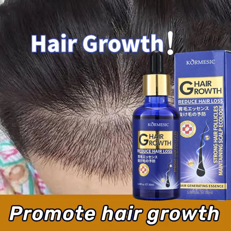 Hair Growth Serum Anti Loss Regrowth Hair Growth Oil Prevent Baldness Repair Damage Scalp Massage Moisturizing Nourish Hair Care