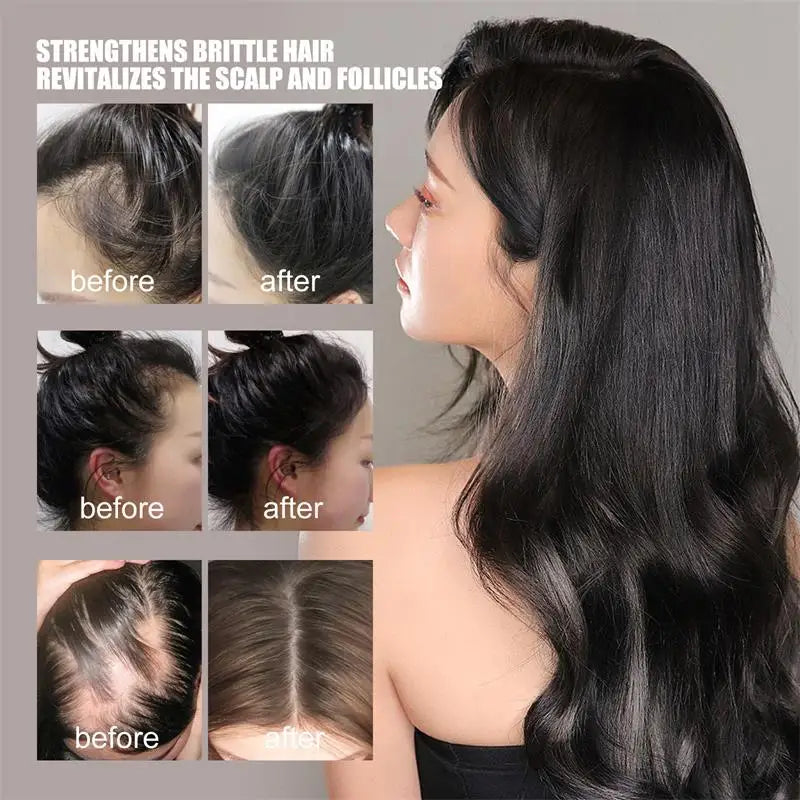 Hair Growth Serum Anti Loss Regrowth Hair Growth Oil Prevent Baldness Repair Damage Scalp Massage Moisturizing Nourish Hair Care