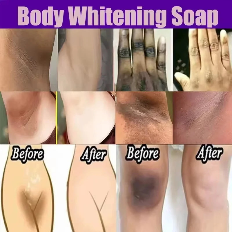 Kojic Acid Body Whitening Soap Deep Skin Bleaching Brighten Body Scrub Knees Intimate Parts Armpits White Nourishing Care Soap