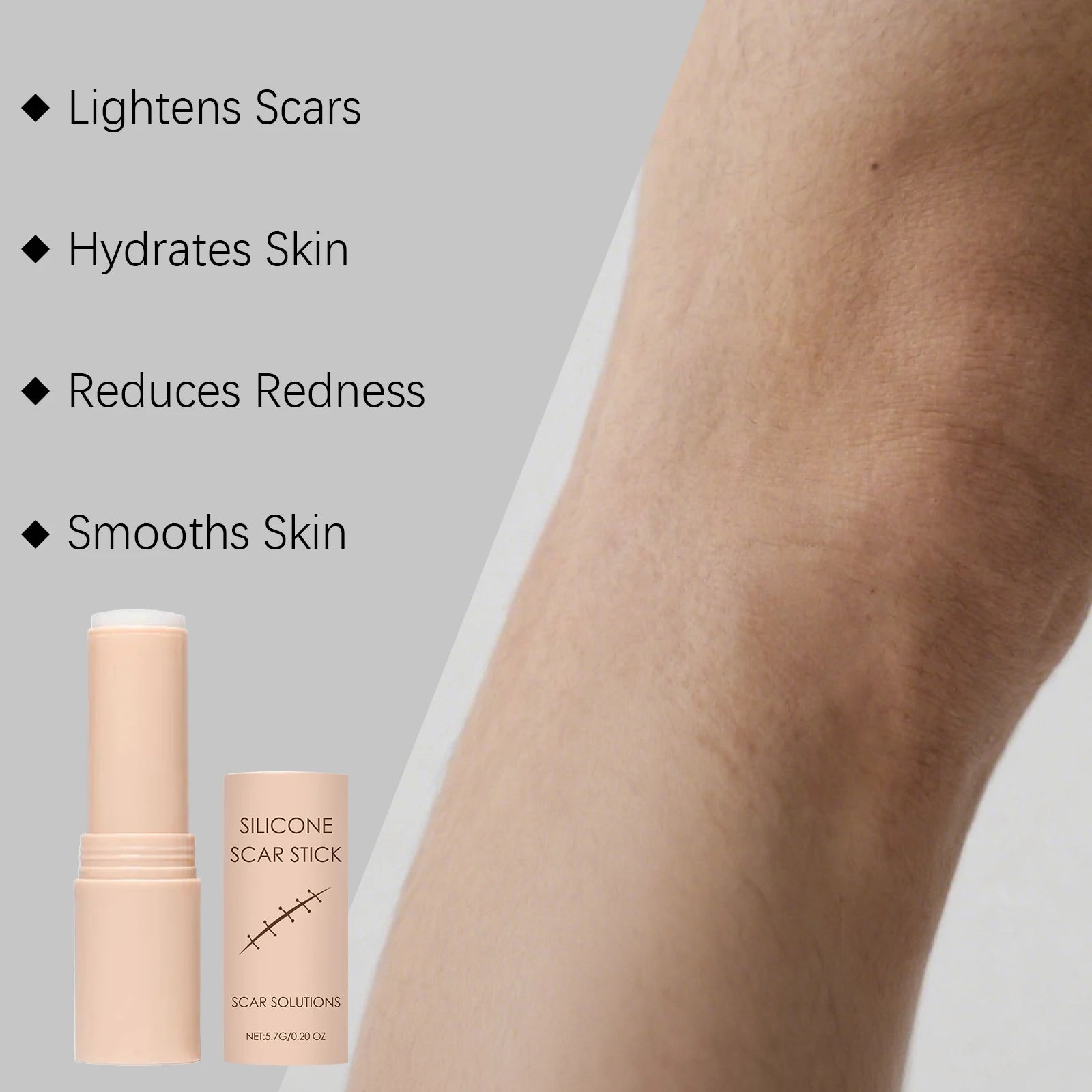 Scar Care Stick Moisturizing For Face Body Skin Smoothing Hydrating Daily Scar Repair Cream Reduce Redness Dryness Care Balm